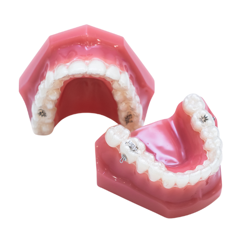 インビザライン