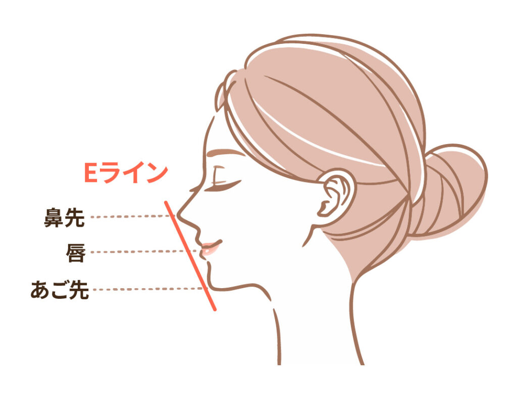 Eラインのイラスト