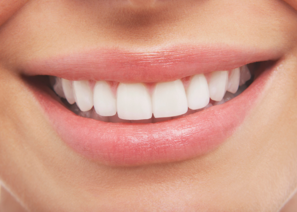 矯正は年齢に左右されません