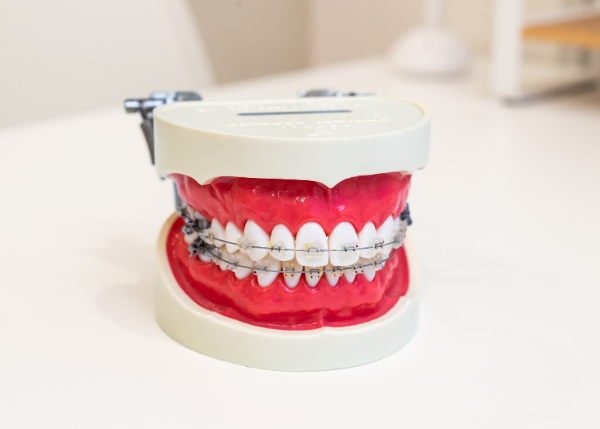 ワイヤー矯正で行う口ゴボ矯正