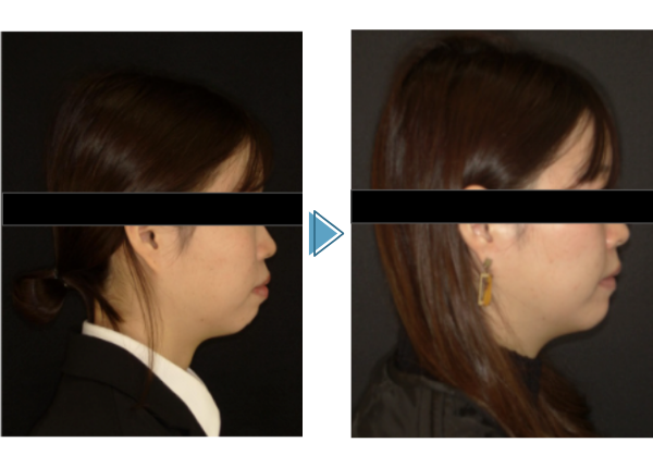 横から見た症例