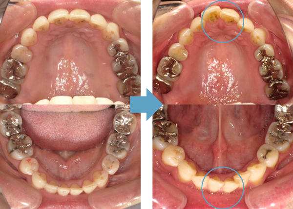 すぐに後戻りしてしまった
