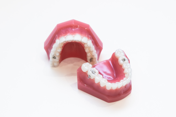 インビザライン