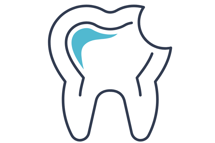 削らない治療のイメージ