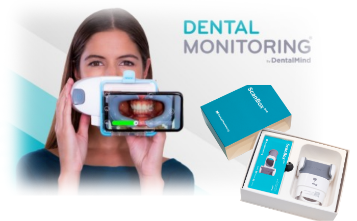 デンタルモニタリングのイメージ