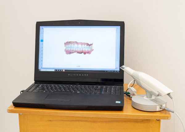 精密検査・3Dシミュレーションの様子