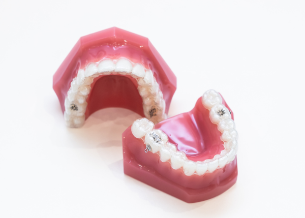 マウスピース装着の様子