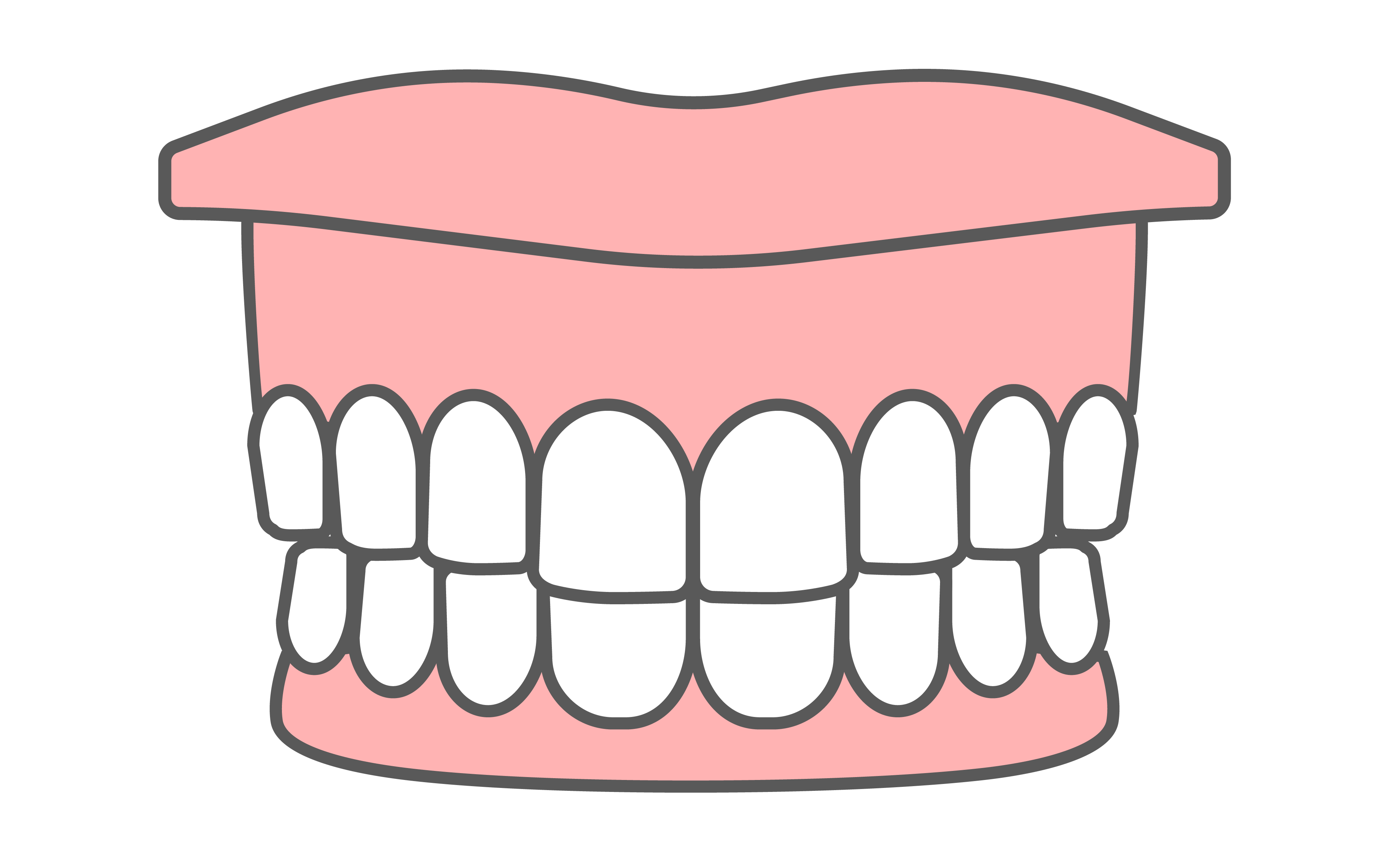 ガミースマイル