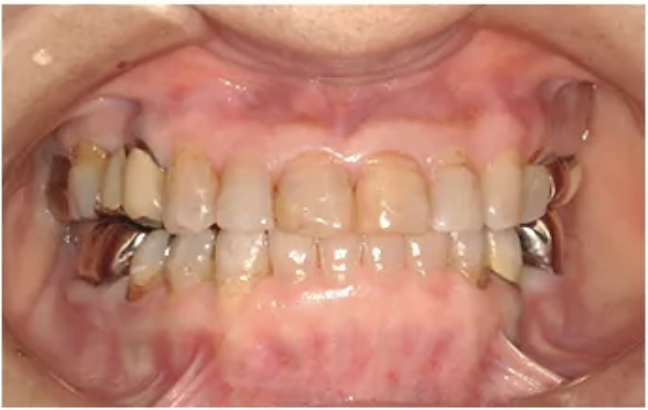 矯正治療・After