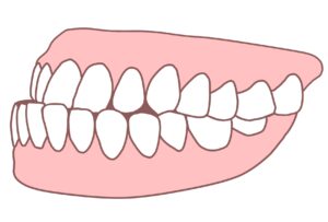 しゃくれのイラスト